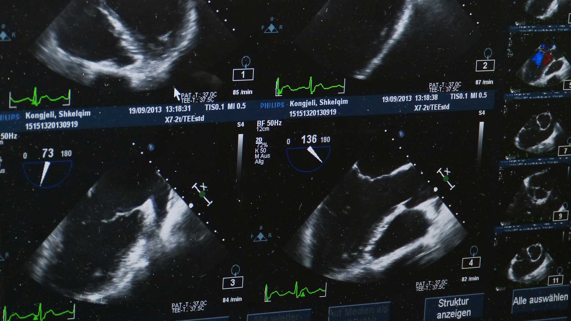 Advantages-of-Medical-Imaging-on-Contribution.Space