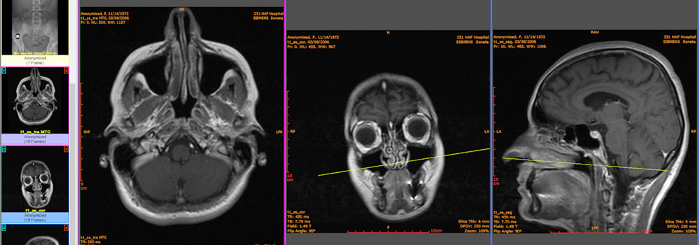 Auto-Populated DICOM Data on ContributionSpace