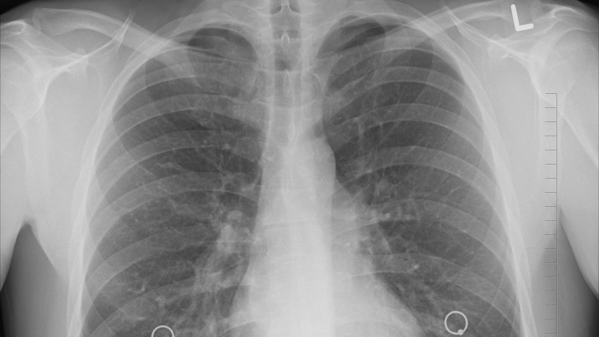 Hospital-PACS-Solution-on-ContributionSpace