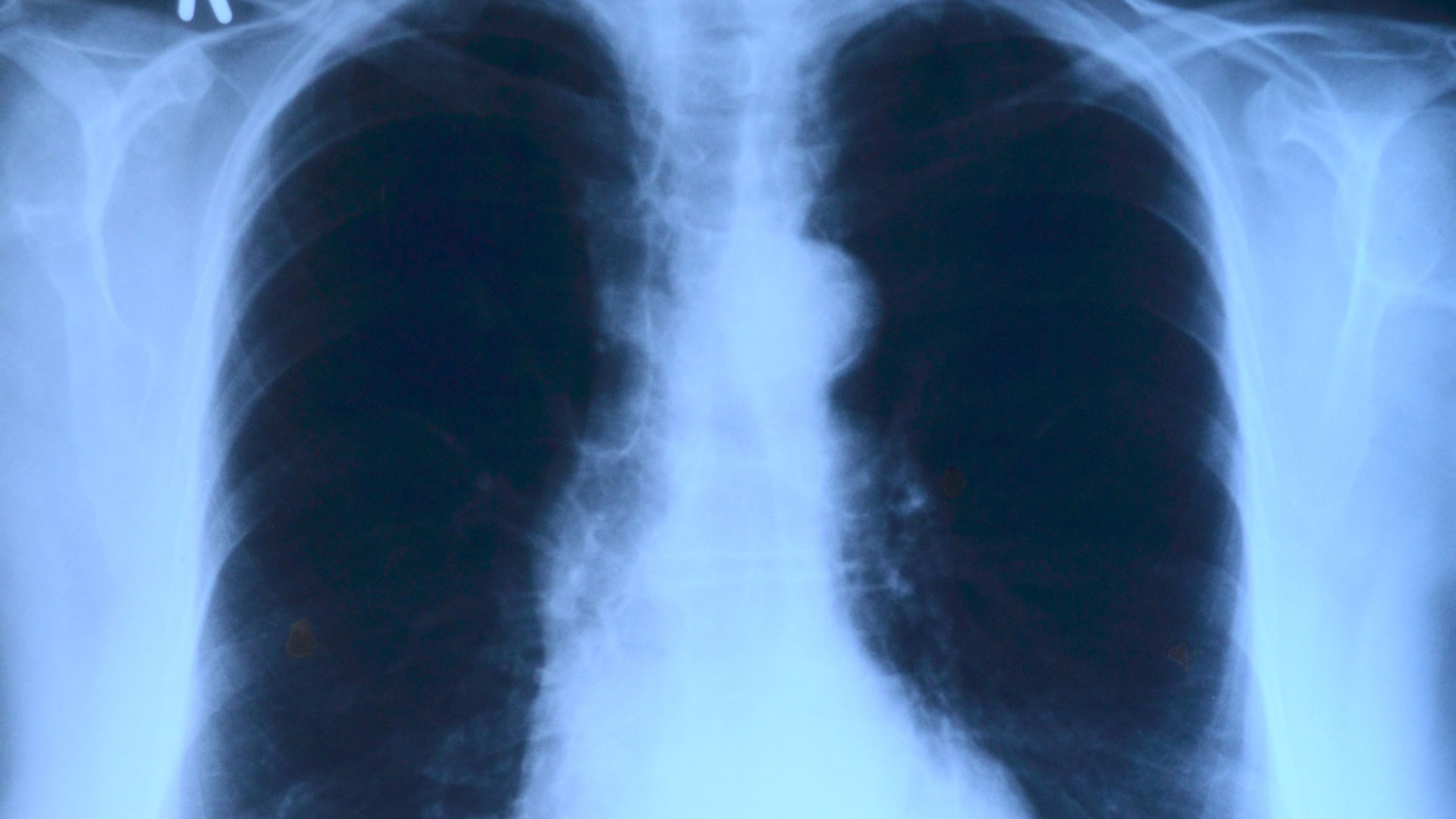 Know-Which-DICOM-Image-Viewer-to-Choose-on-ContributionSpace