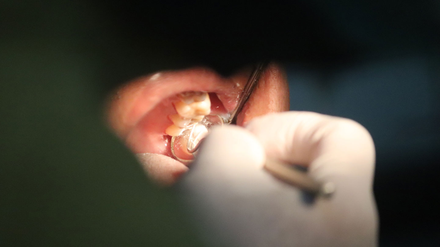 Some-Simple-Signs-Indicate-You-Have-a-Cavity-on-contribution