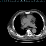 HTML5 PACS viewer