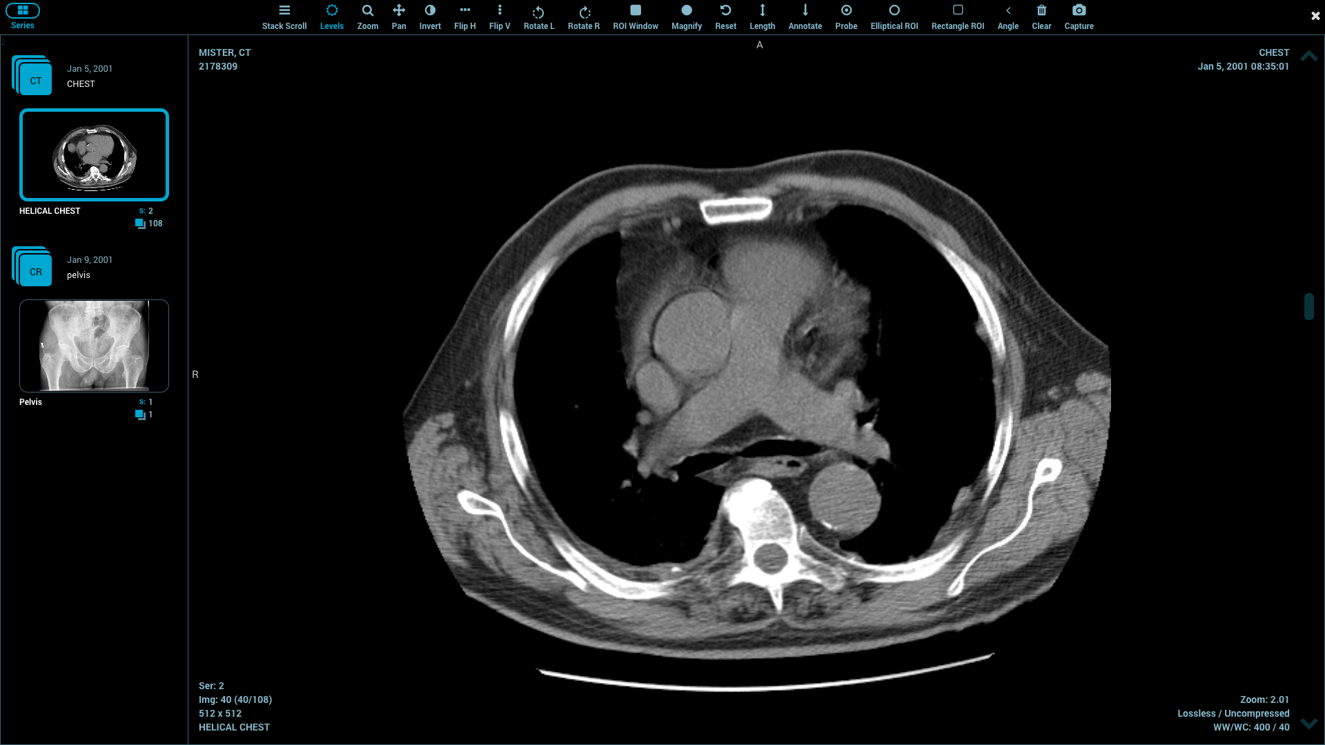 HTML5 PACS viewer