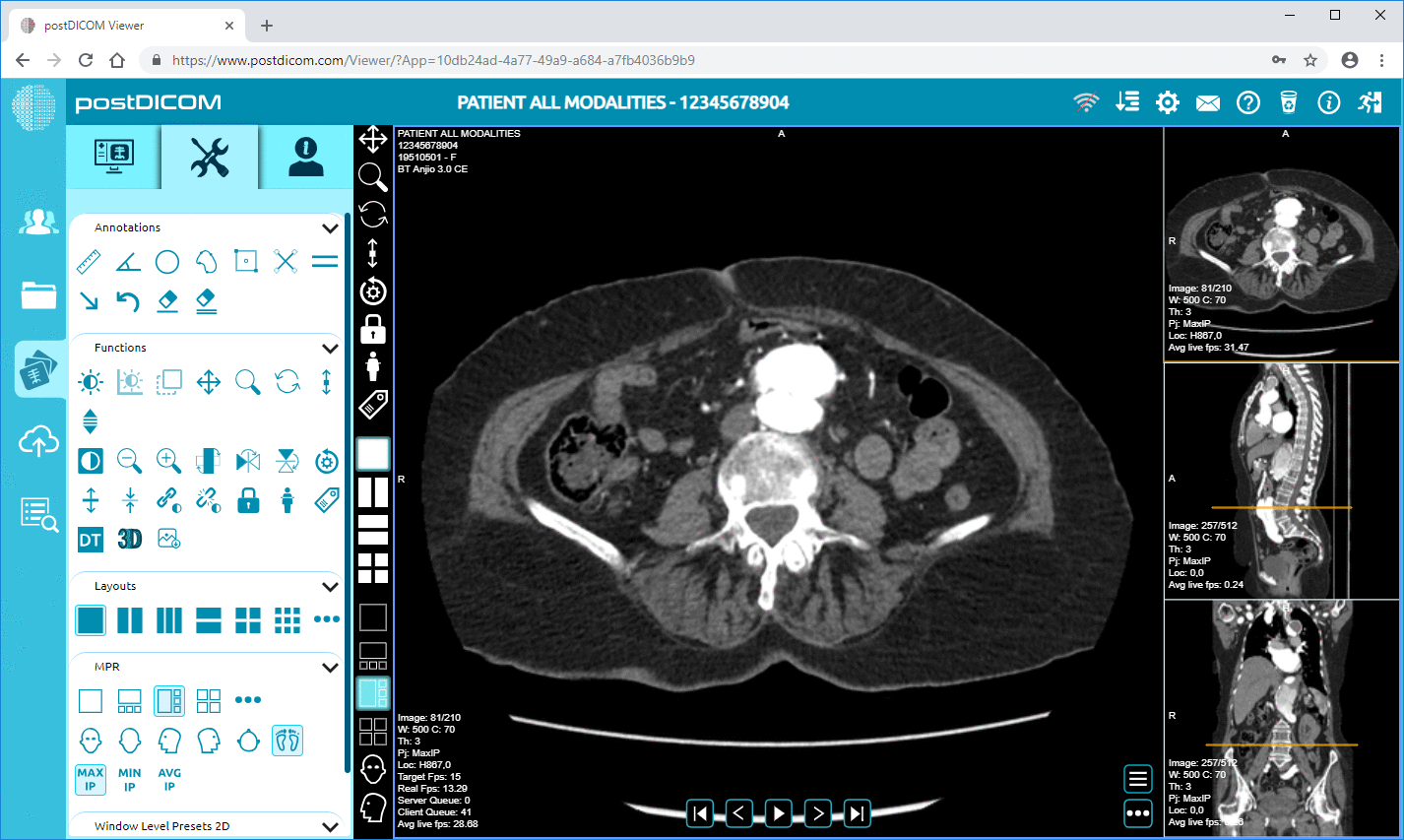 DICOM viewer PACS