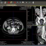 DICOM medical image viewer