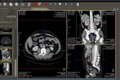 DICOM medical image viewer