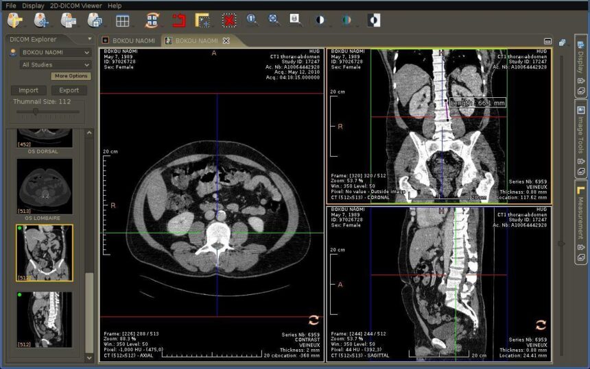 DICOM medical image viewer